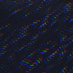 Hallucination