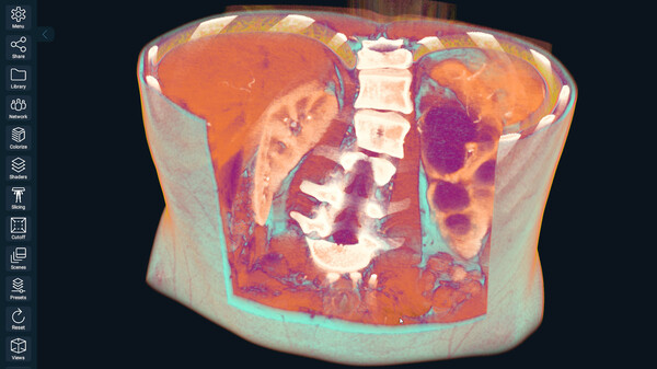 3D Organon
