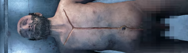 Autopsy Simulator video 1