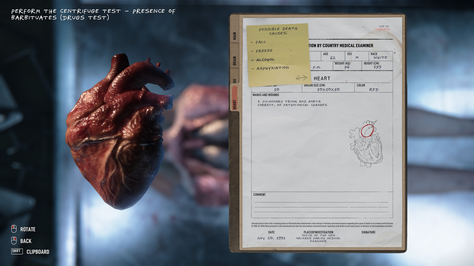 screenshot of Autopsy Simulator 3