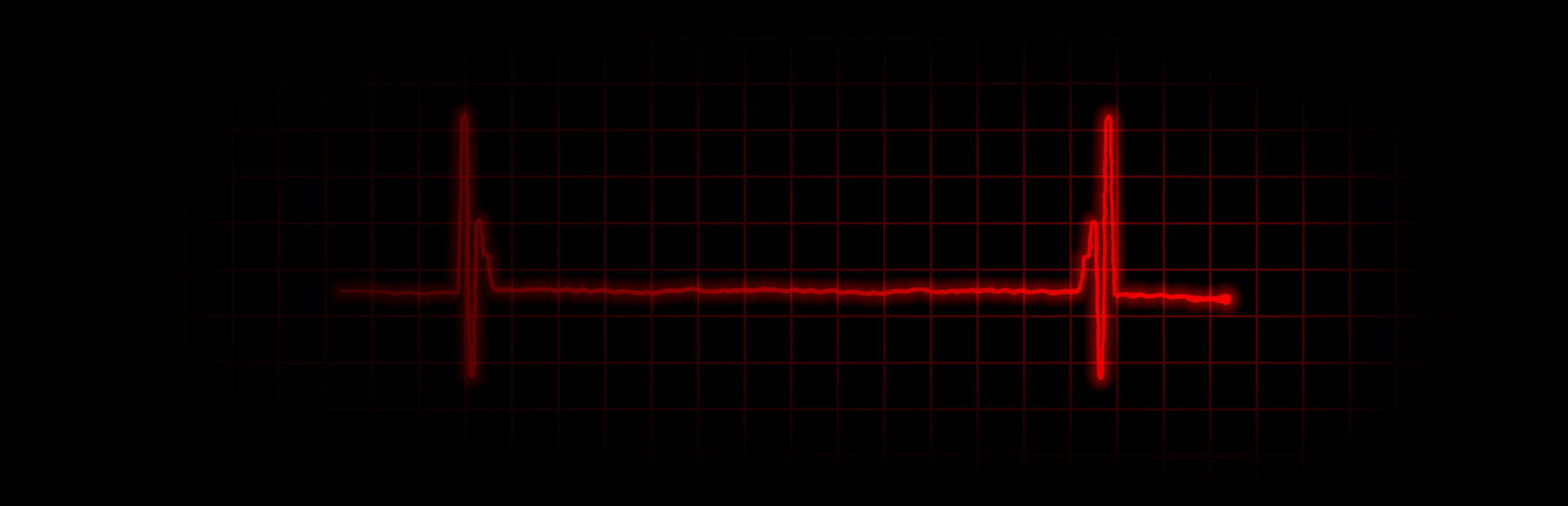 Heartbeat: Regret