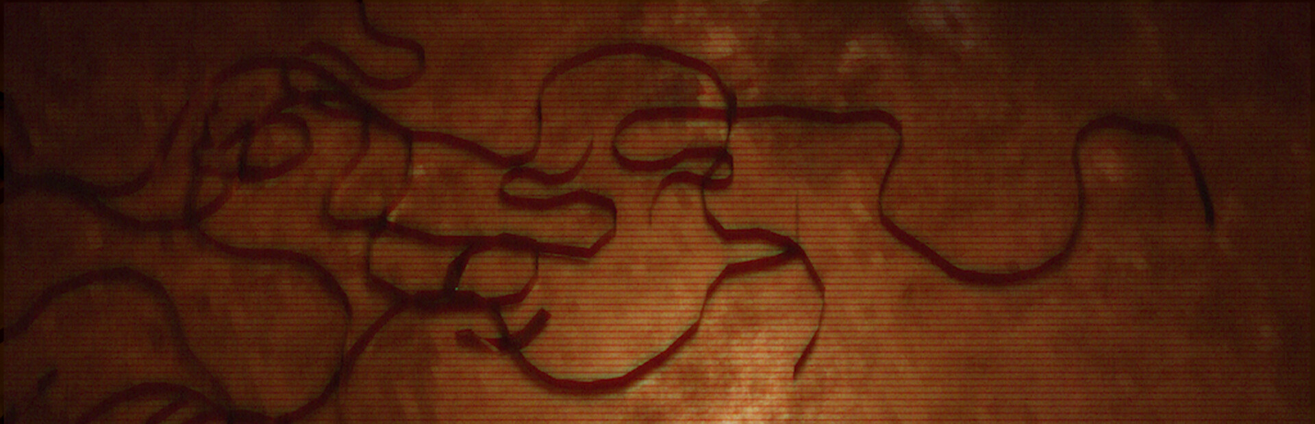 R00000