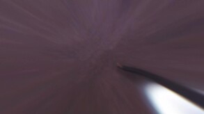 Zombie Survivals [18+]🧟‍♀️🔞 screenshot thumbnail video