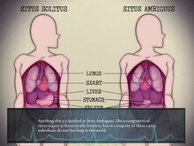 Amare Inversus screenshot thumbnail video