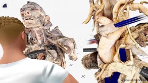 The Heart Valves. Understanding the Structure, Function, and Importance of Heart Valves
