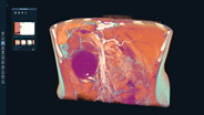 XR Medical Imaging