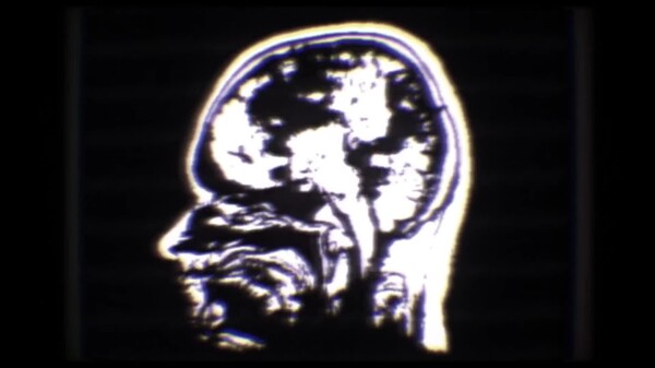 Trailer video thumbnail for Symptoms of Infection