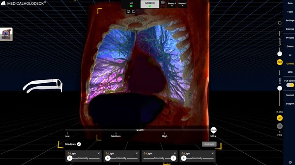 Spatial Medical Imaging Thoracic