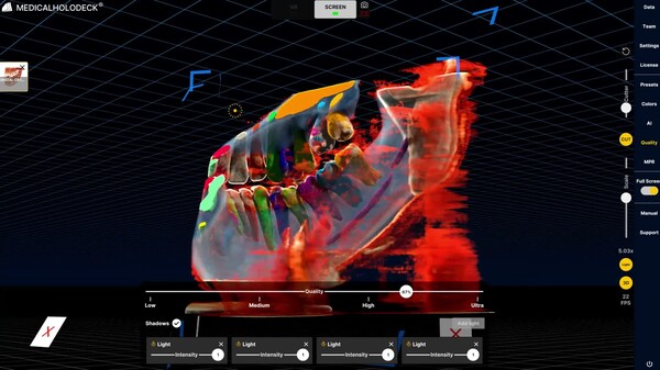 Spatial Medical Imaging Dental