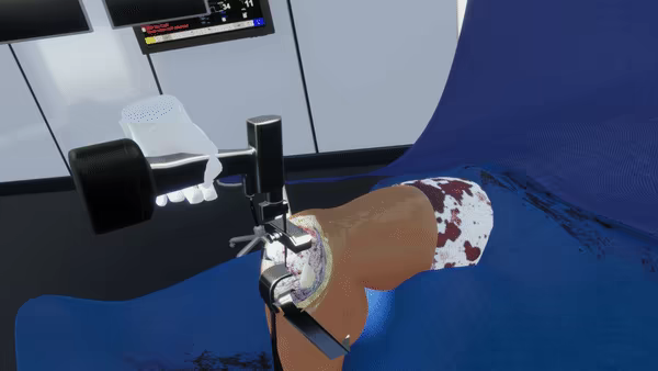 VR TKA Surgery Simulator video 3