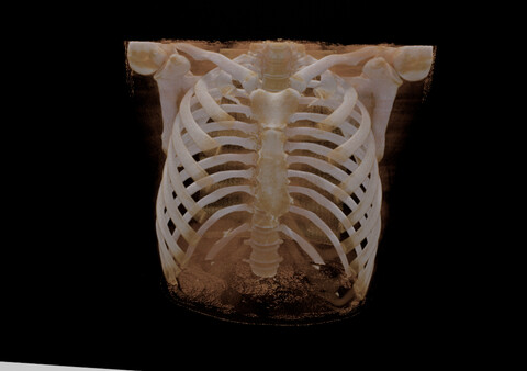 Bodyscope screenshot 3