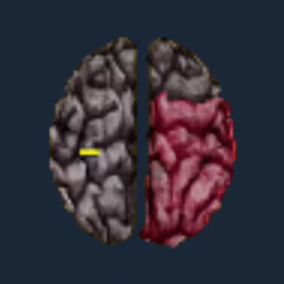 Broken Psyche video 4