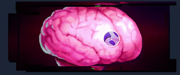 IDET video 5