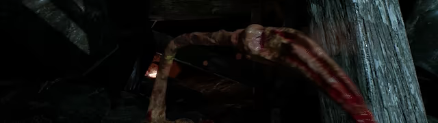 Chemical-Burn video 4