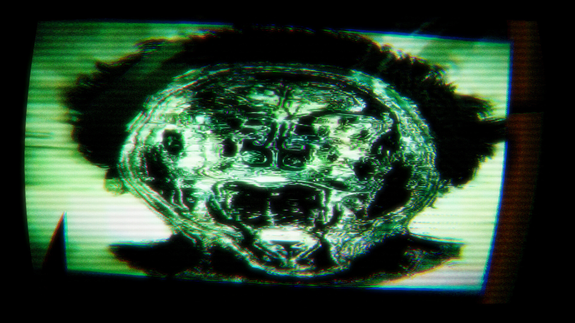 Youchosis screenshot #13