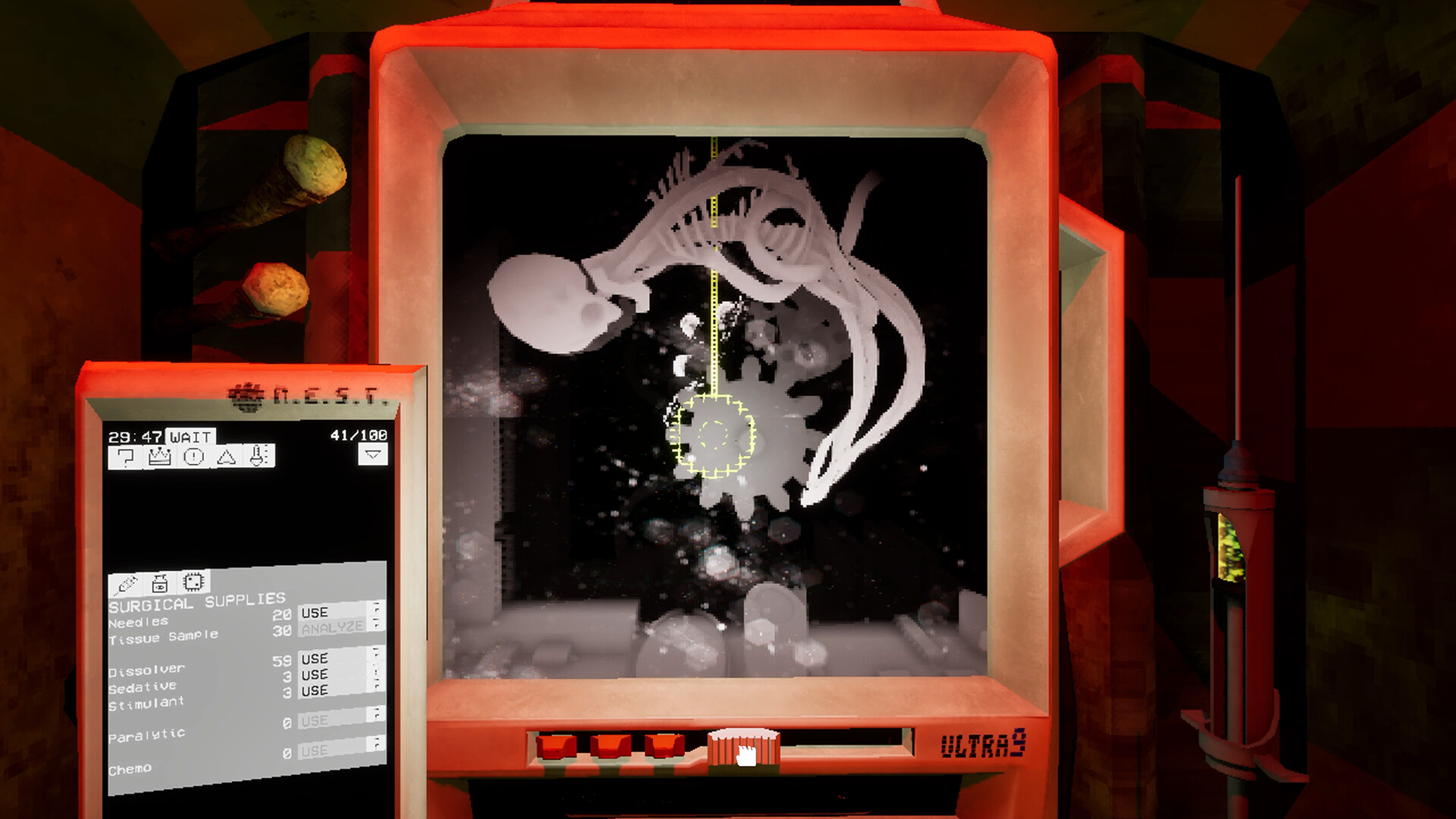 Ultrasound screenshot #1