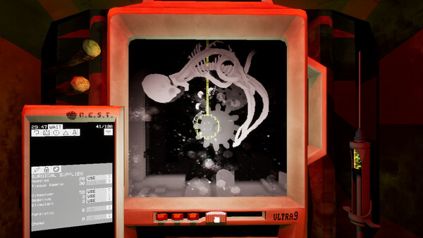 Ultrasound