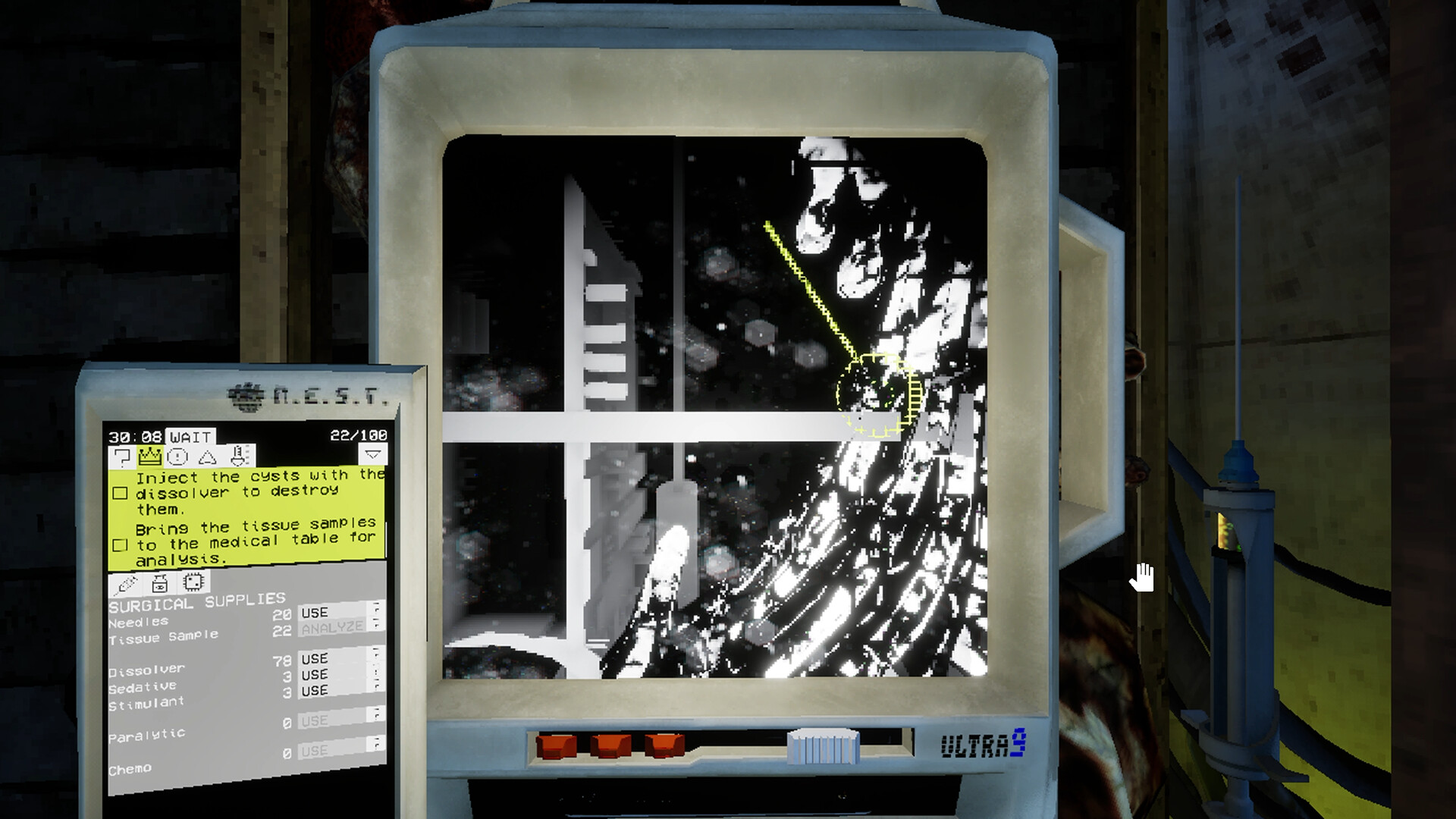 Ultrasound screenshot #8