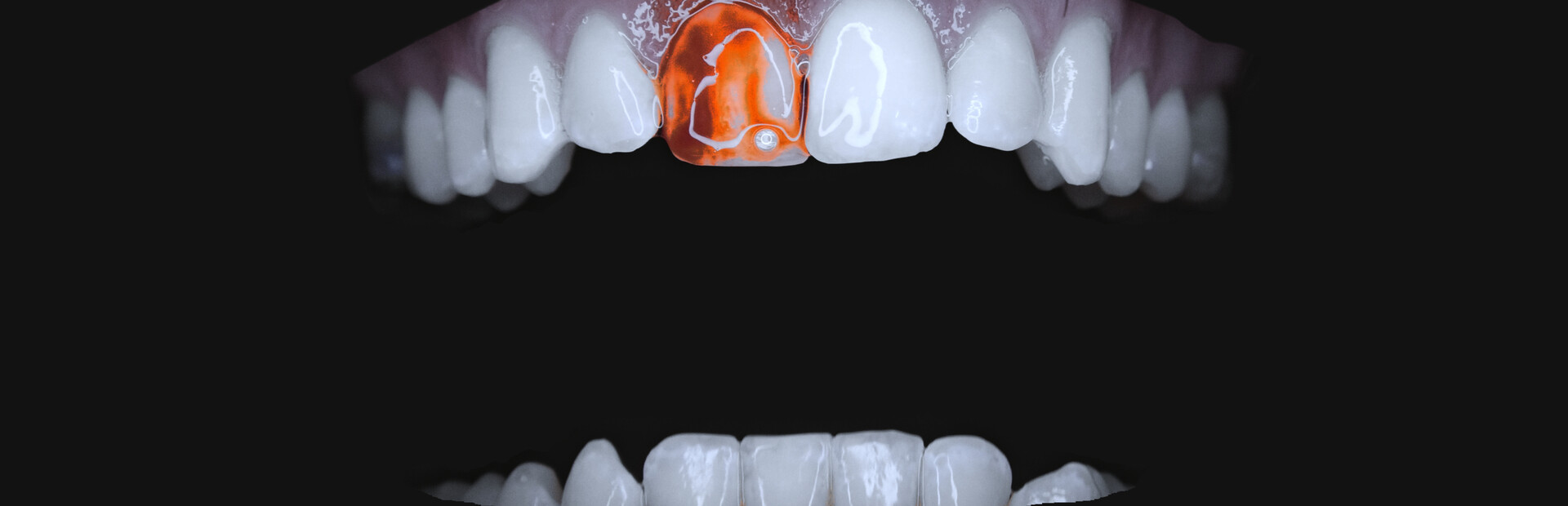 Teeth Cutter