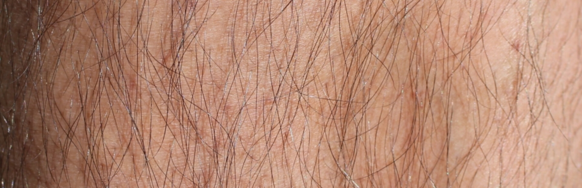Pubes