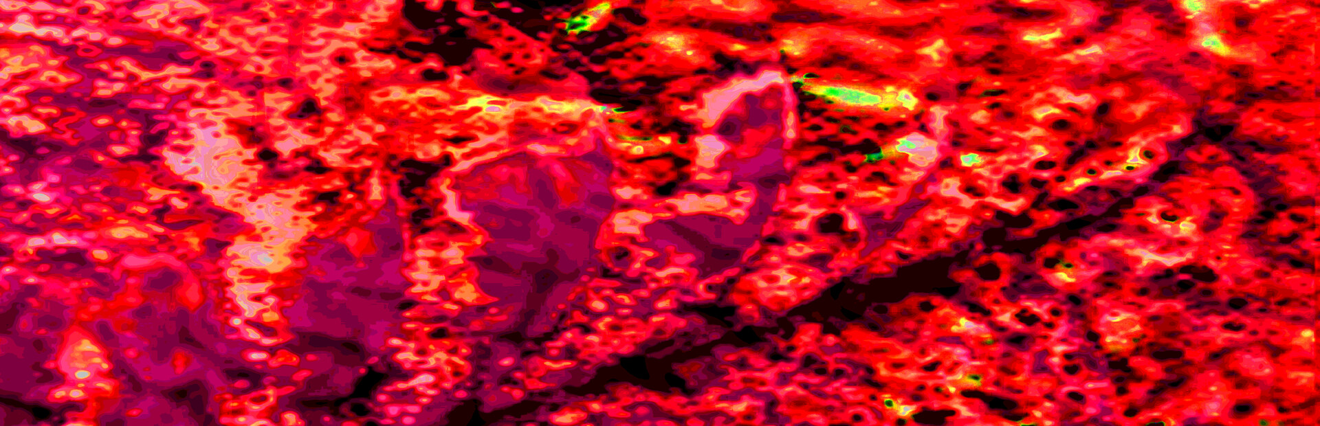 Neurospasm