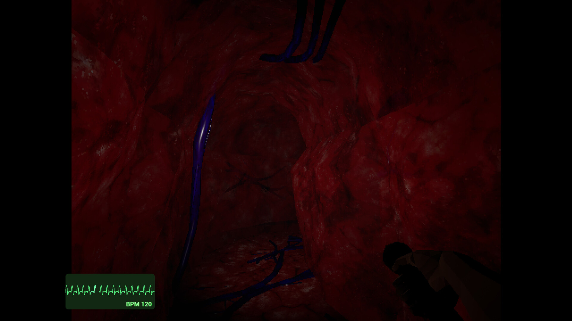 Cabin Heart screenshot #4