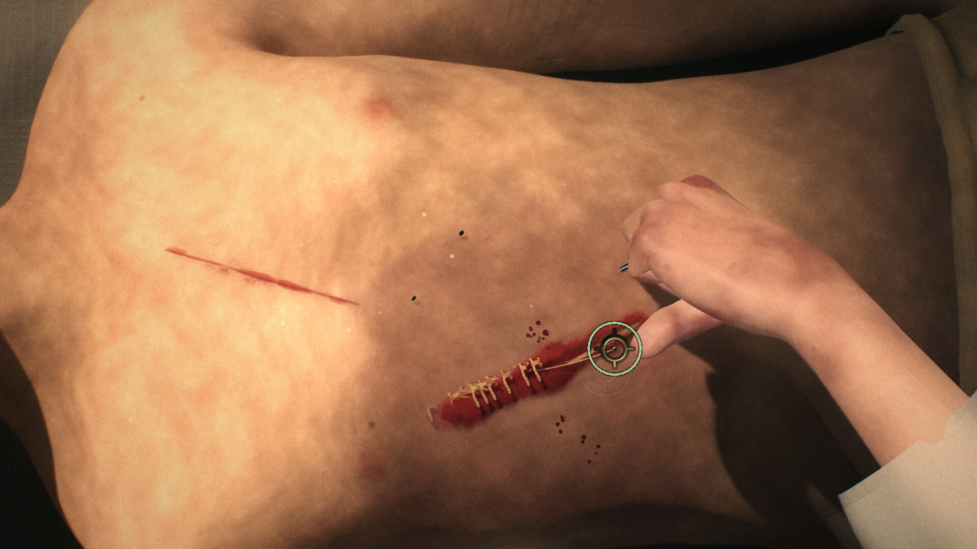 Field Surgeon 遊戲畫面 2