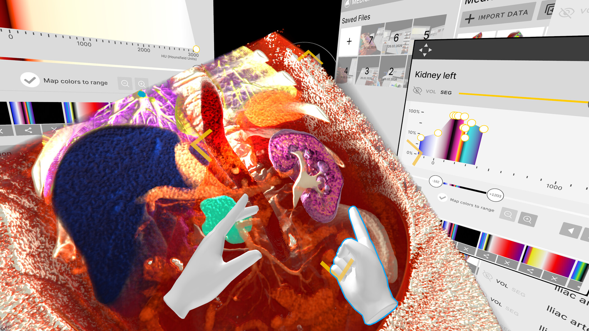 Medicalholodeck – Medical imaging, AI and anatomy in 3D screenshot 6