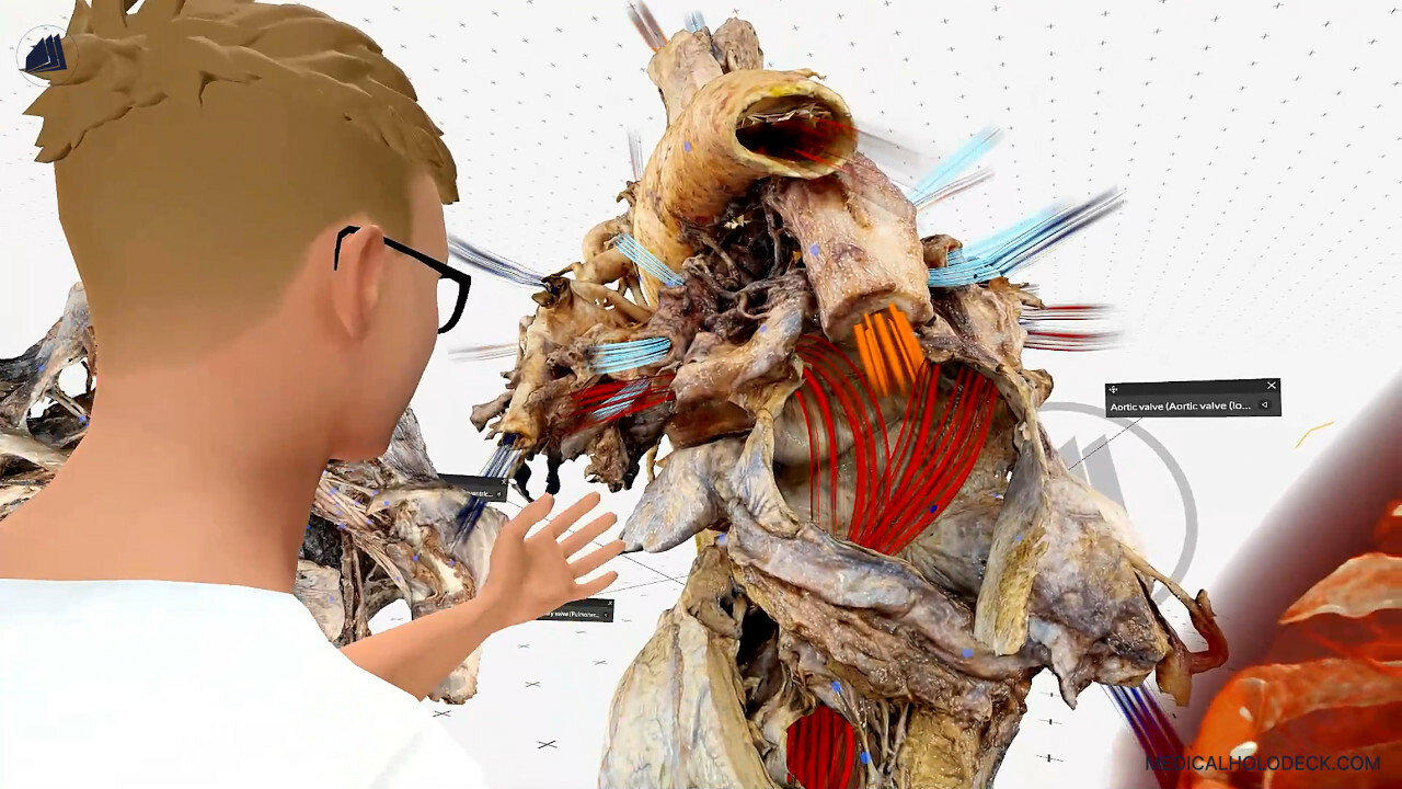 MEDICALHOLODECK®. Surgery, Anatomy, Medicine, and DICOM in Virtual Reality. For Medical Students, Nurses, Doctors and Surgeons. screenshot 2
